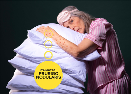 HIGHLIGHT_PROJECTS_PRURIGONODULARIS-_521px